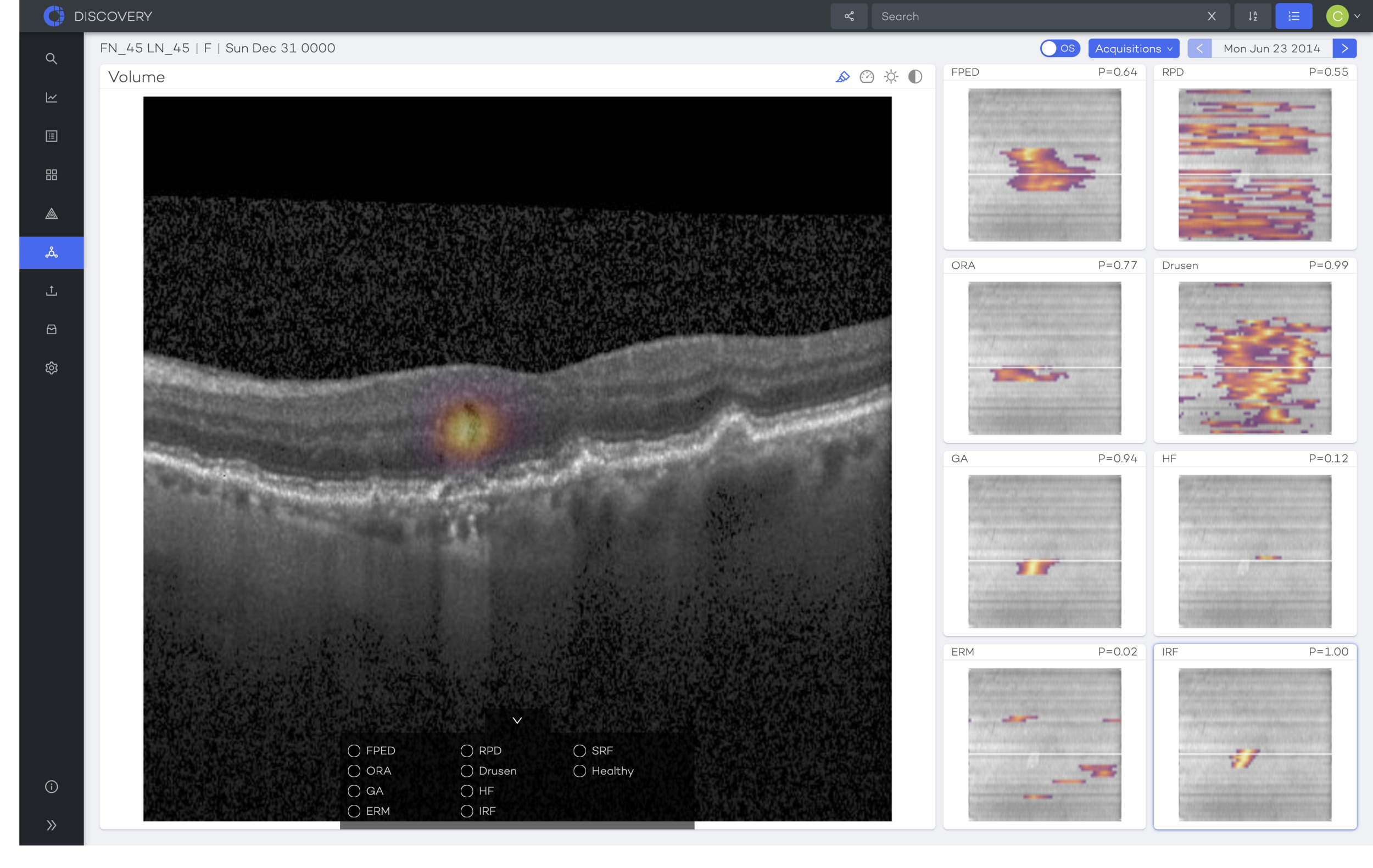 Biomarker_view.png
