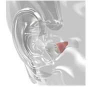 Diagram of Hearing Aid Placement in Ear