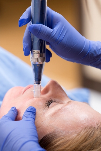 procedure1.jpg