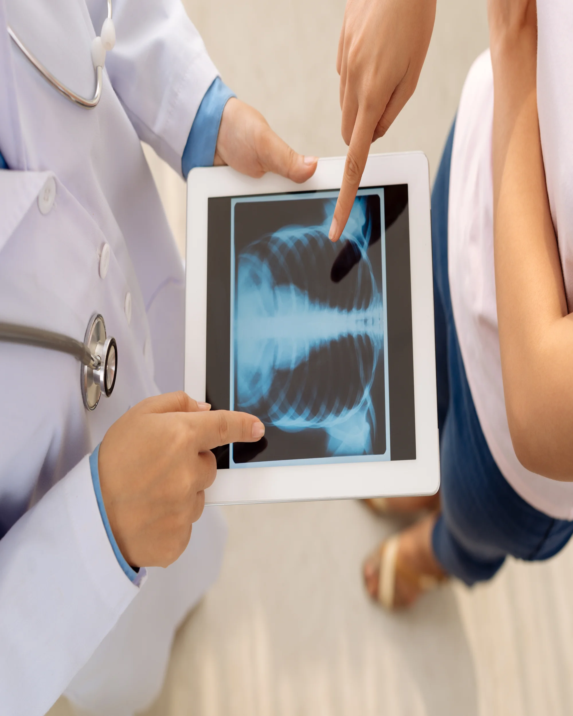 storyblocks-doctor-showing-chest-x-ray-on-digital-tablet-to-female-patient-view-from-above_S8g_fBNTZM.jpg