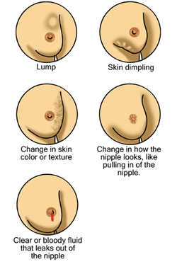 I Have Large Areolas