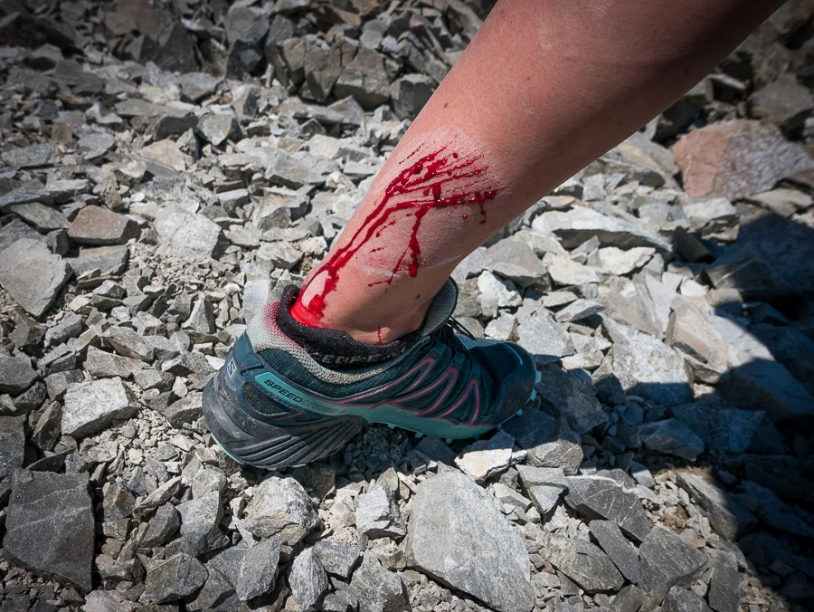 A rock hit Soph's leg which caused a bit of bleeding but luckily we had the first aid kit and this was the worst injury of the trip. Photo: Pete Oswald
