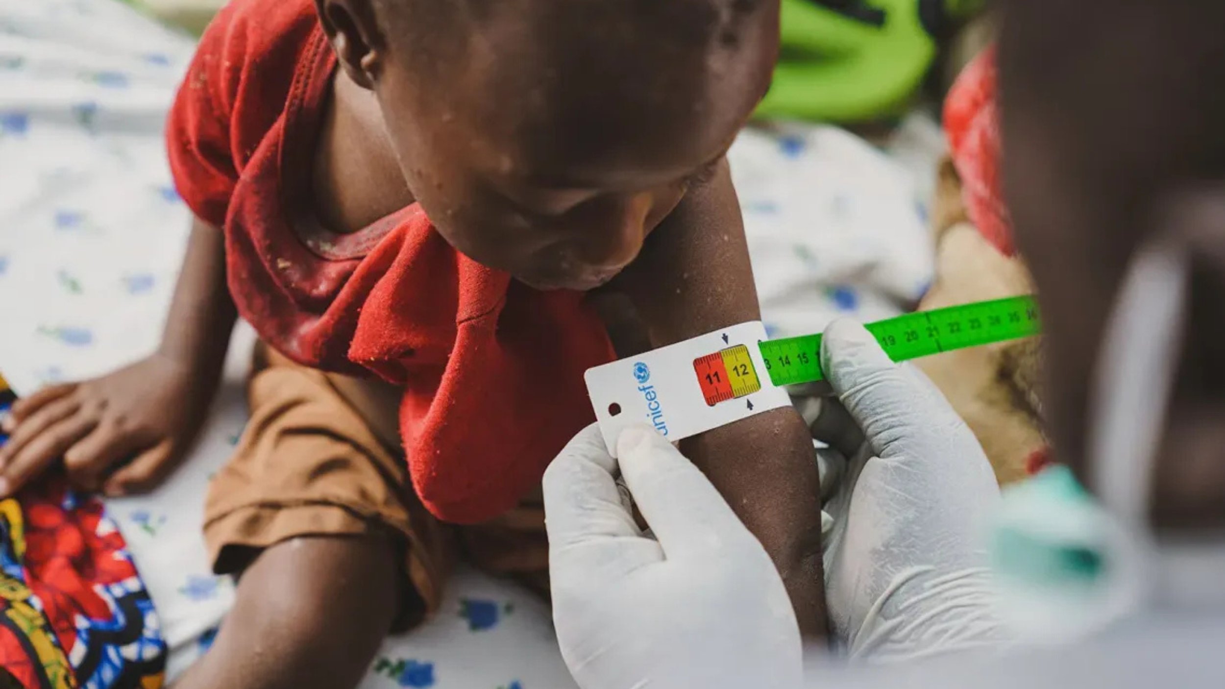 A gloved health worker wraps a UNICEF measuring tape around a child’s upper arm, with the reading window showing the red and yellow bands.