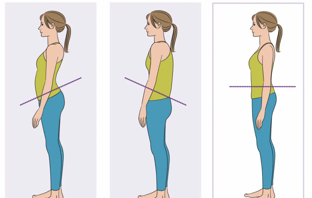 The Problem With Telling Patients Their Pelvis Is&nbsp;“Stuck” in Anterior or Posterior Tilt