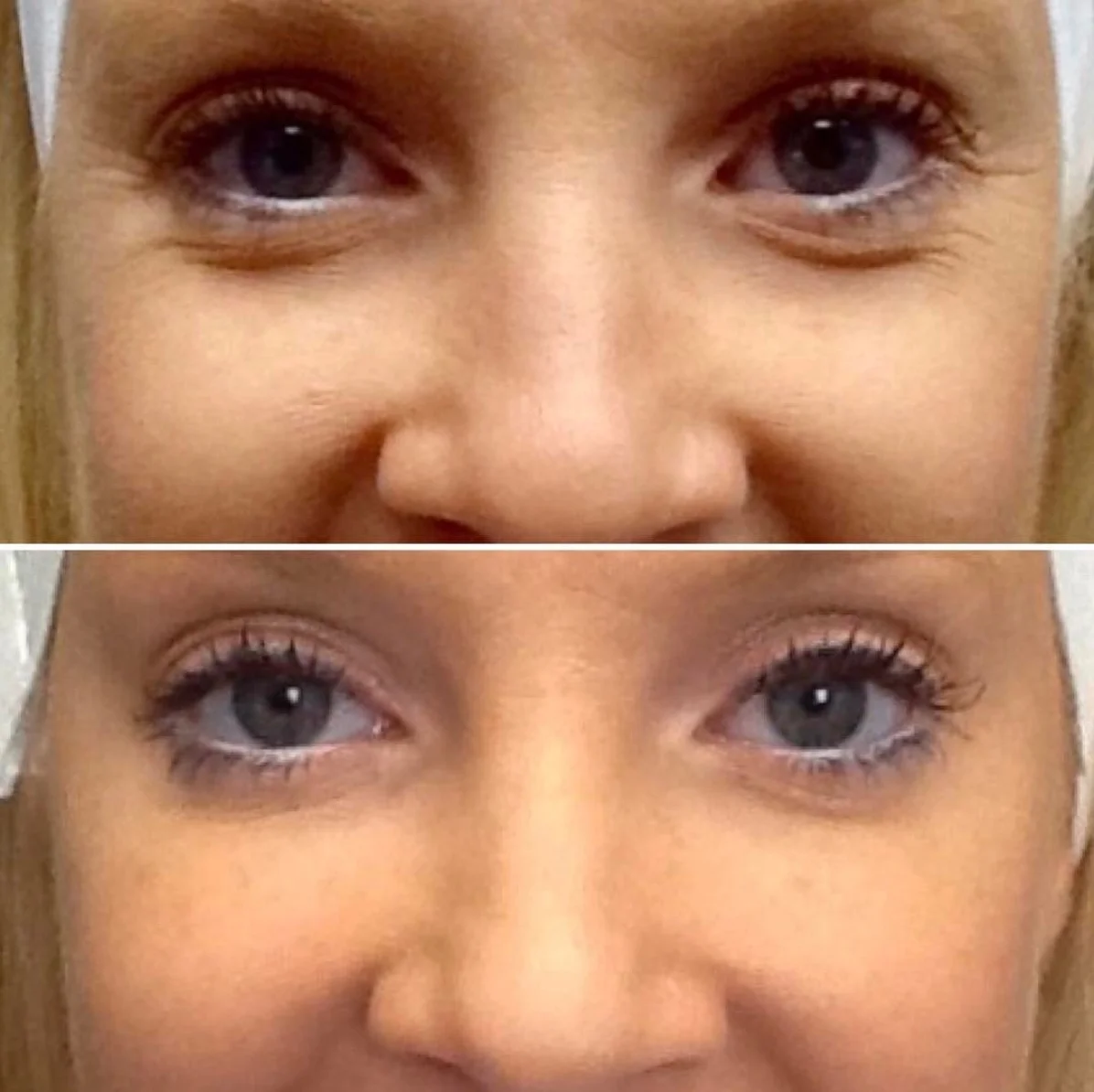 Eyes