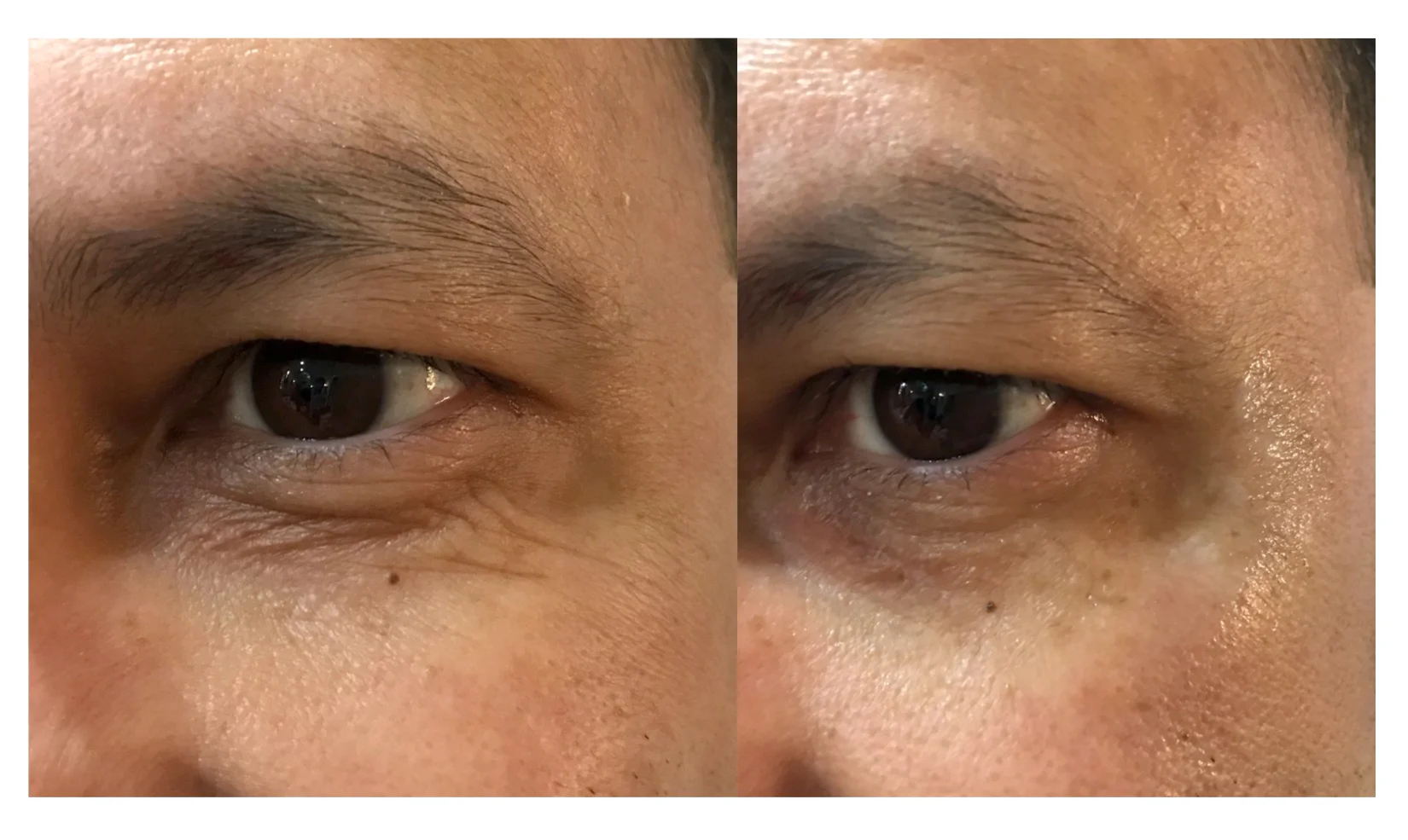 Age Expression Eliminator