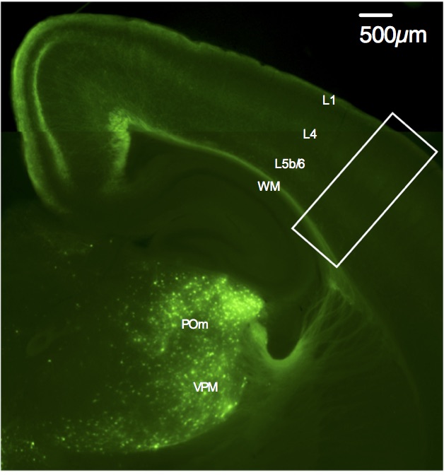 An E11.5 in utero electroporation of ChR2-EYFP into the mouse thalamus (imaged at P21), which I performed as part of a project during my PhD.