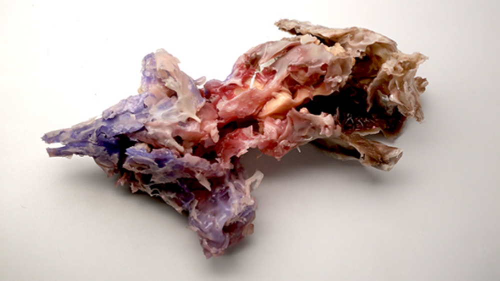  Single silicon teratoma unit 