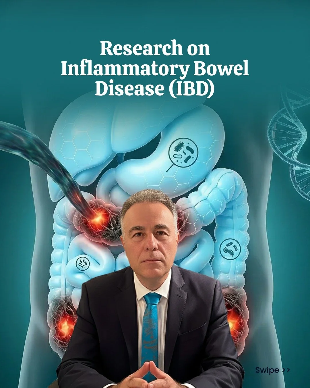 IBD isn&rsquo;t just a gut condition.
It&rsquo;s influenced by sleep, stress, diet, and the microbiome.

Research shows these factors interact; affecting inflammation, gut barrier function, and immune response.

Managing IBD may require more than med