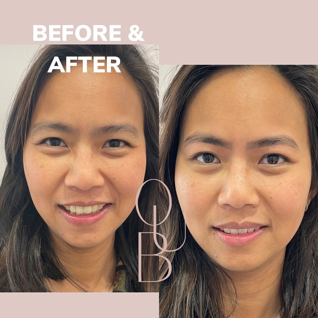 Natural brow design and restoration is what we love to do. Book in now through our website www.onceuponabrow.com or the book link on our Instagram.

#ouab#ouabbrows#bestperthbrowstudio#browlamination#savethebrow#savethenaturalbrow#naturalbrows#softbr