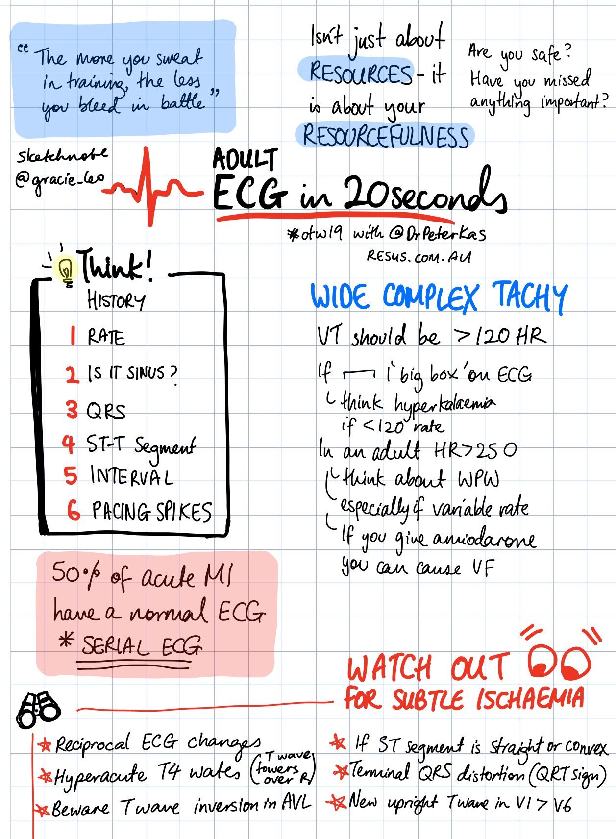 Adult ECG in 20 Seconds - from OTW Conference 2019