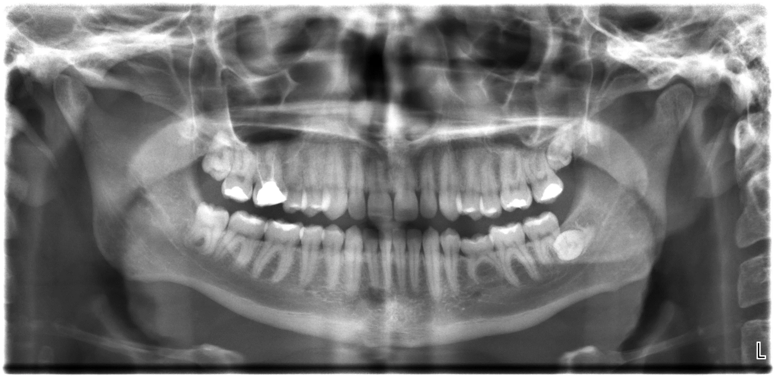 Dental_X-rays.JPG
