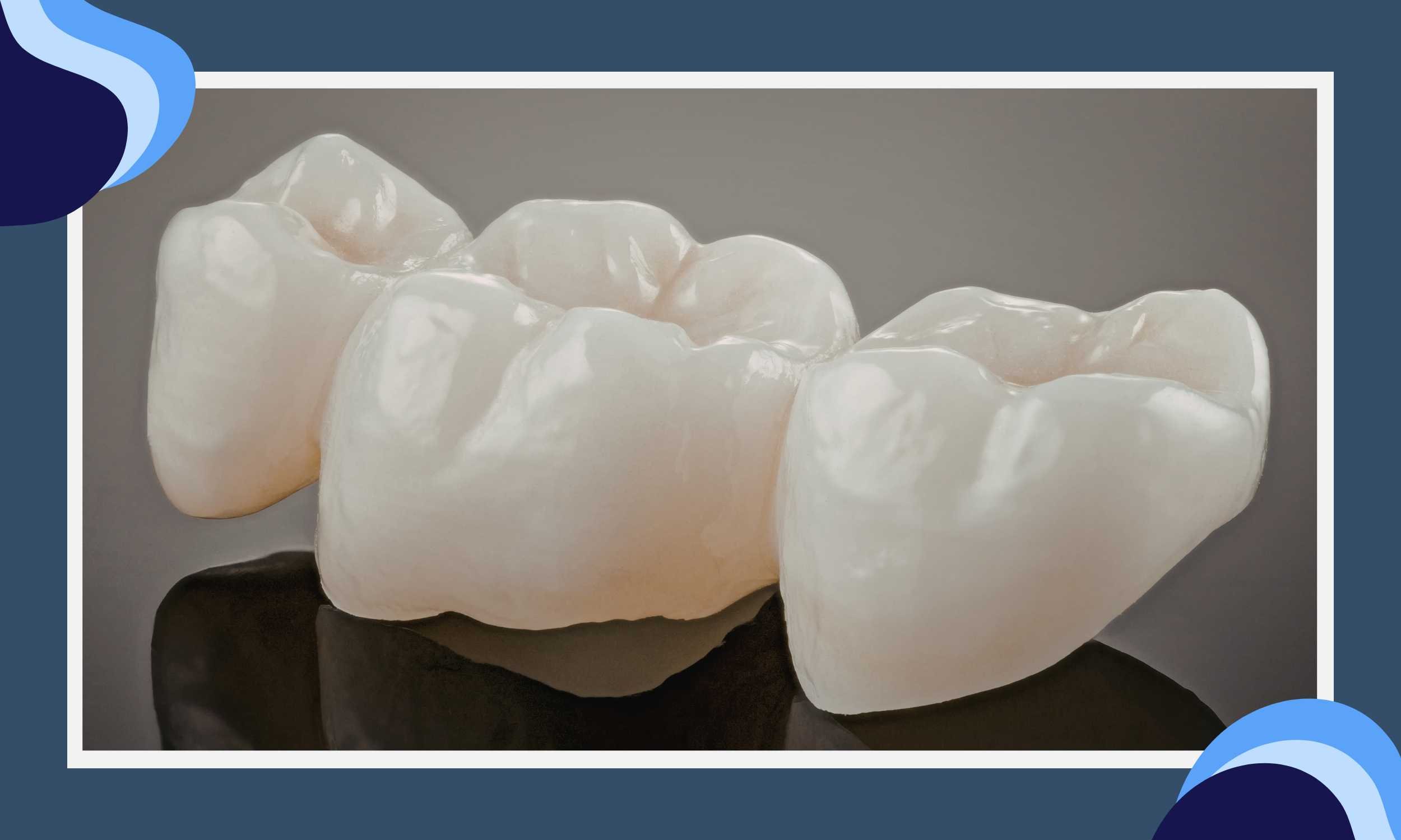 What Parents Should Know About Stainless Steel and Tooth-Colored Crowns