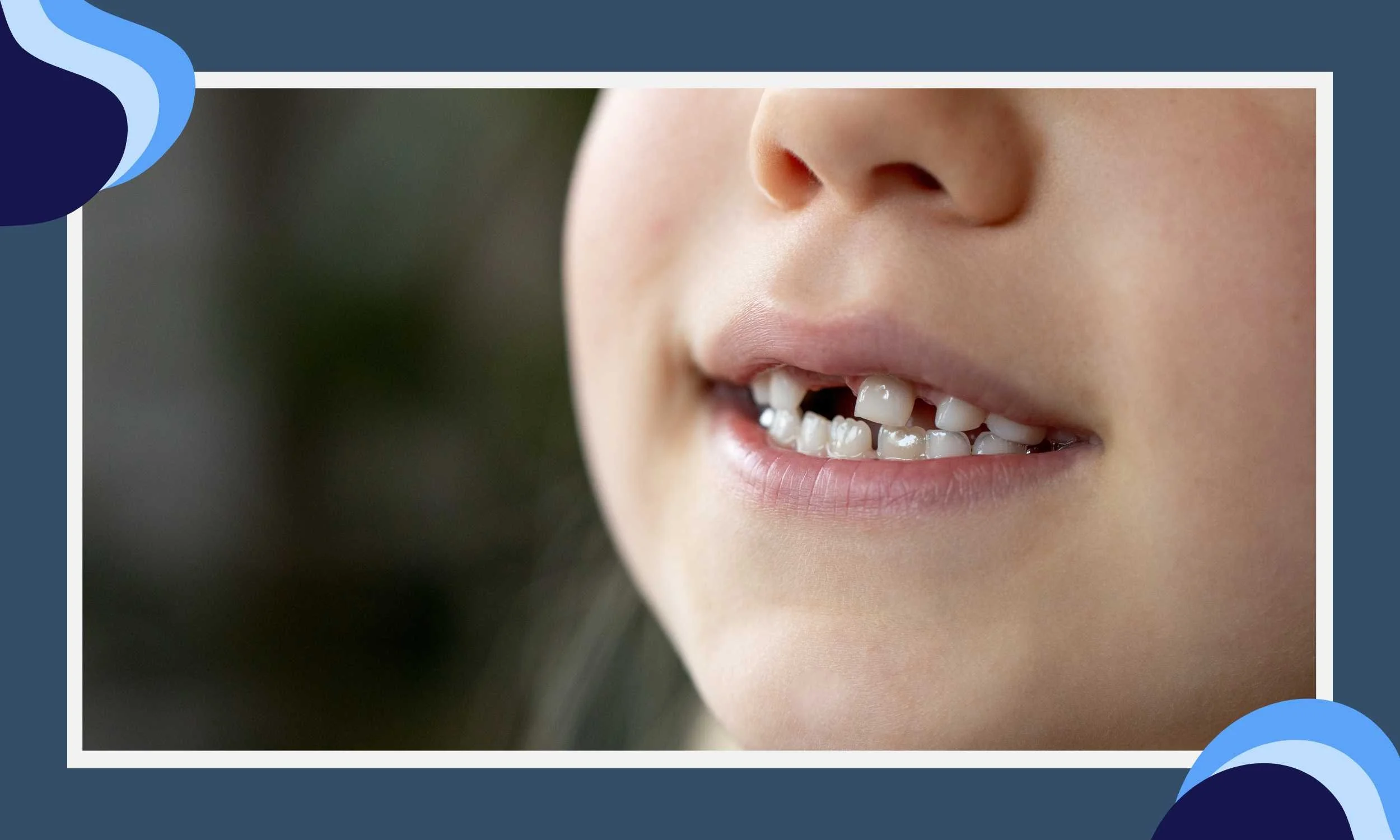 Understanding Space Maintainers for Kids