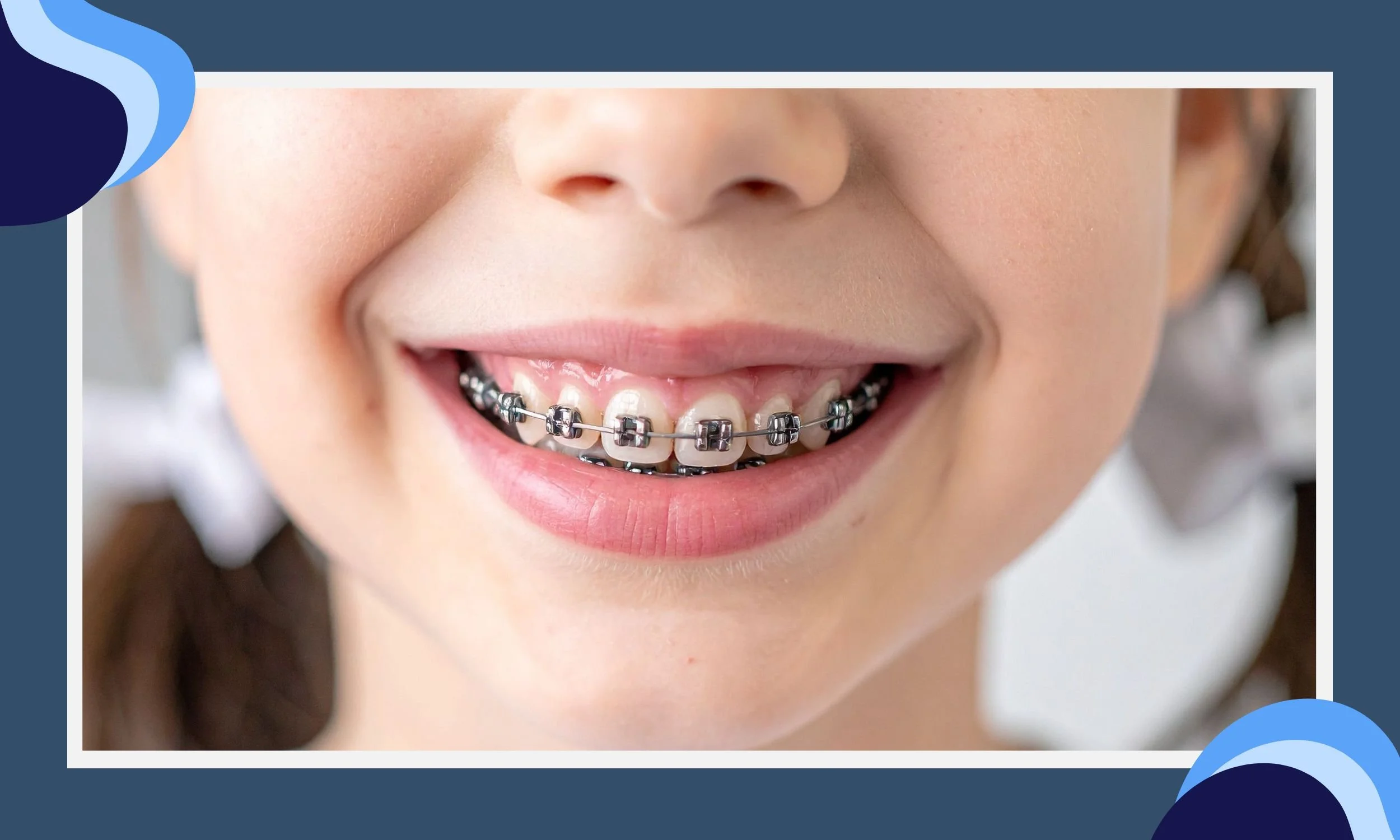 Early Signs Your Child May Need Orthodontic Care