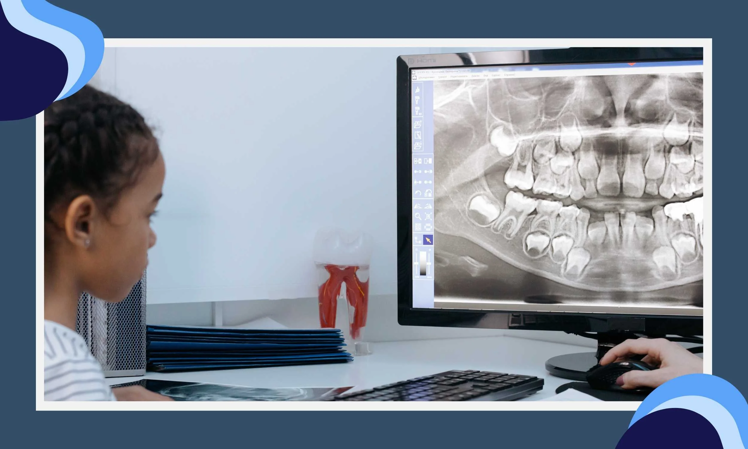 What Dentists Can Spot in Your Child’s Dental X-Rays