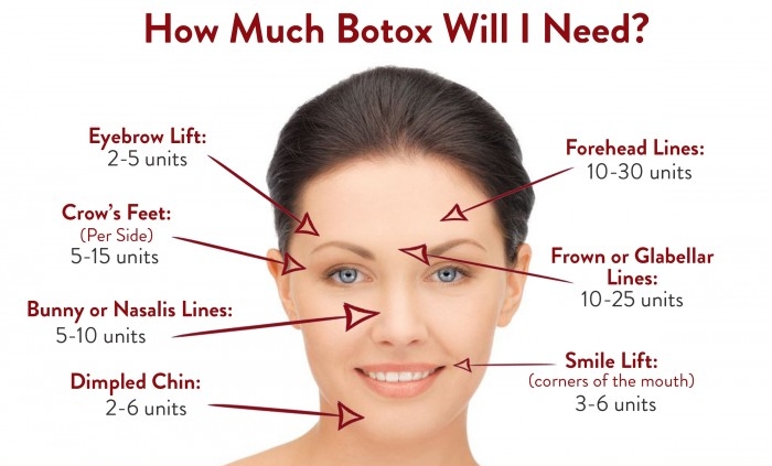 Botox.jpeg