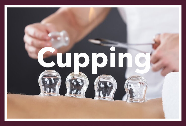 Cupping Therapy in Northfield, Illinois