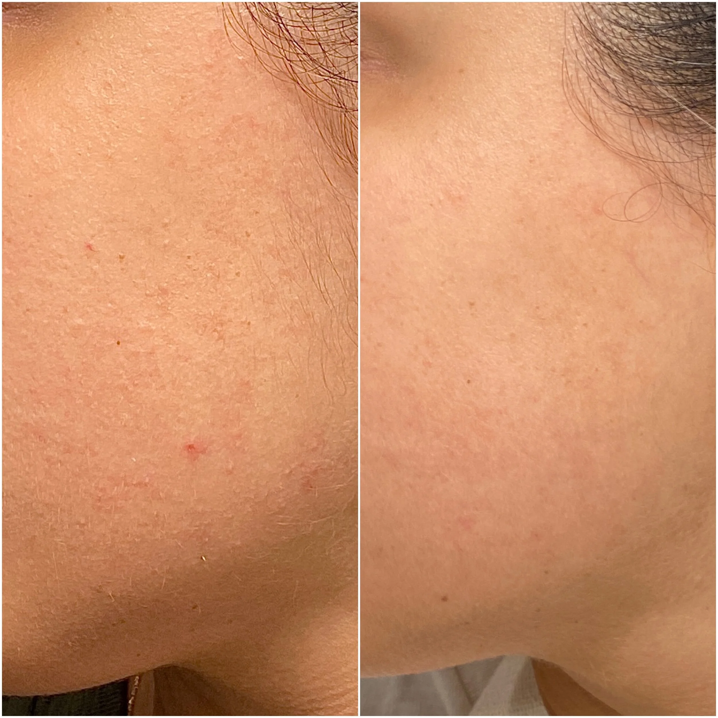 How I Got My Very Sensitive Skin Under Control