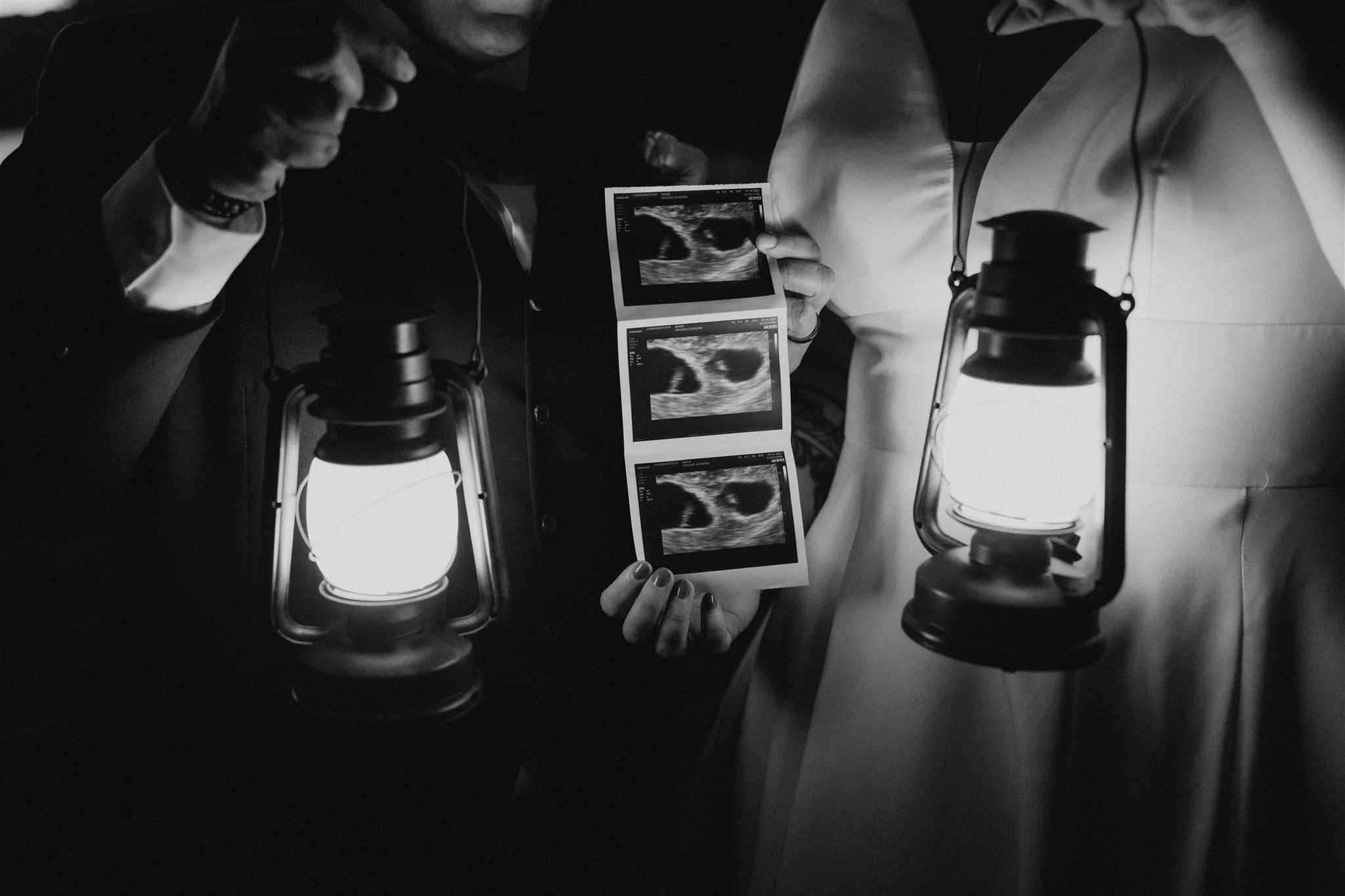 Two brides holding lanterns and ultrasound photos