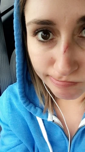 The shitty gash aftermath