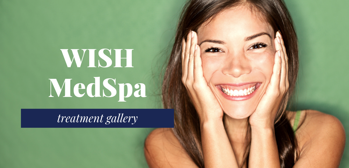 WISH MedSpa Gallery website banner.png