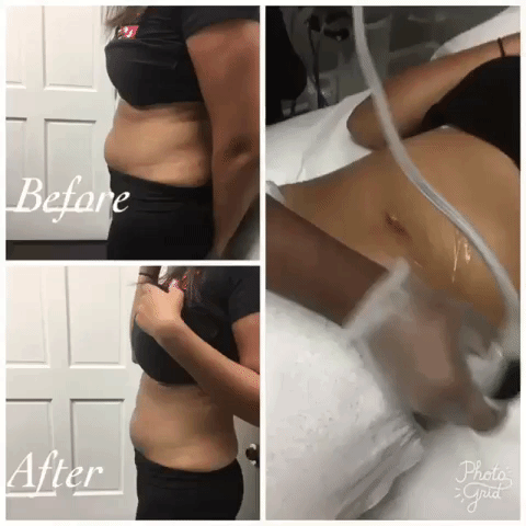 bodyslimming gif.gif