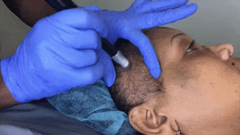 HairLossTreatmentsAtlanta.gif