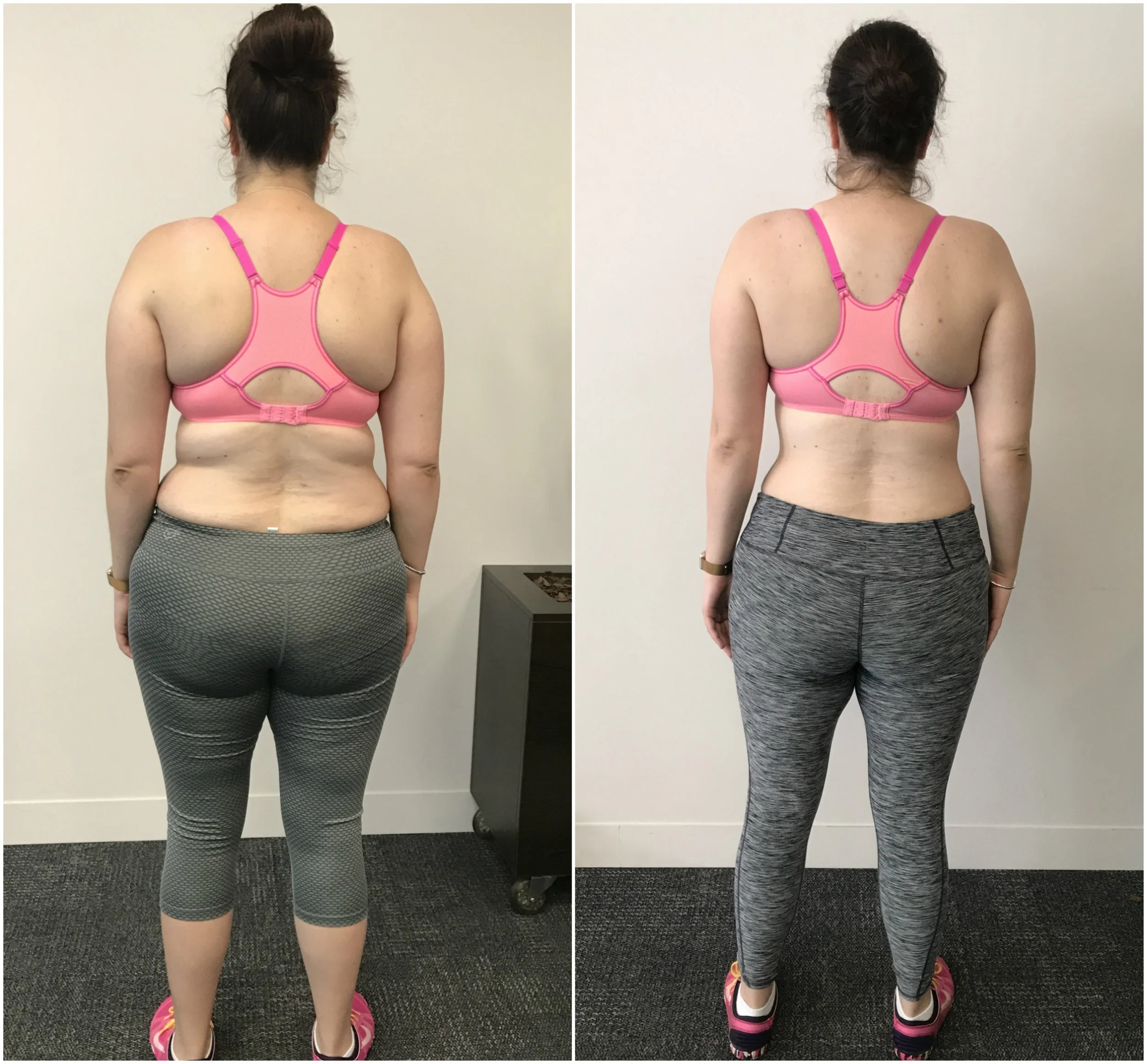 Livia Back B & A.jpg