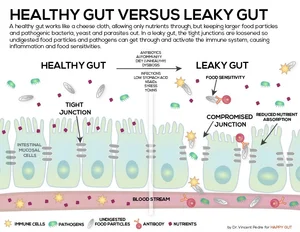 How to Heal a Leaky Gut Naturally | Magnolia Wellness OC