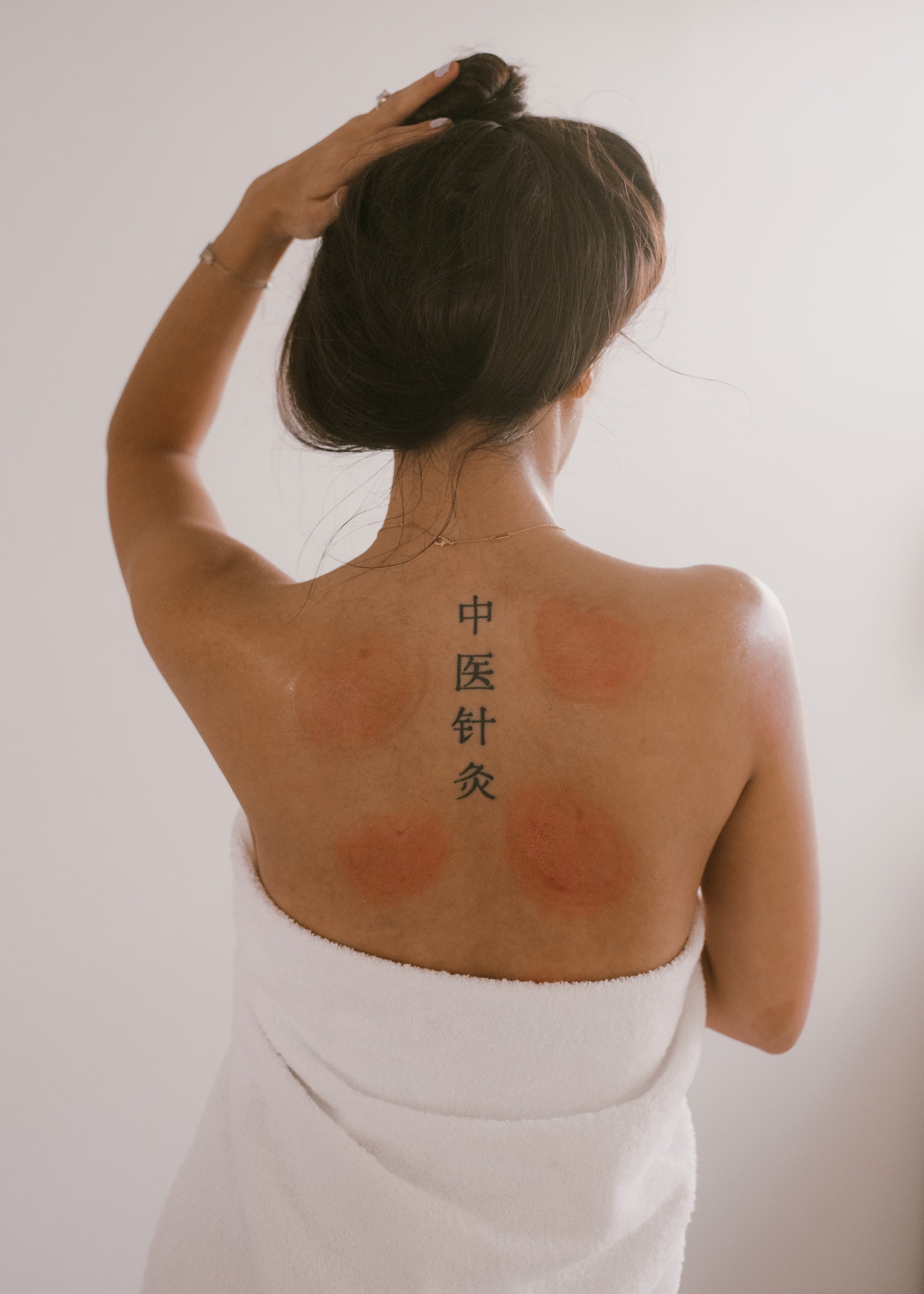 Acupuncture in Costa Mesa, Newport Beach & Orange County Magnolia