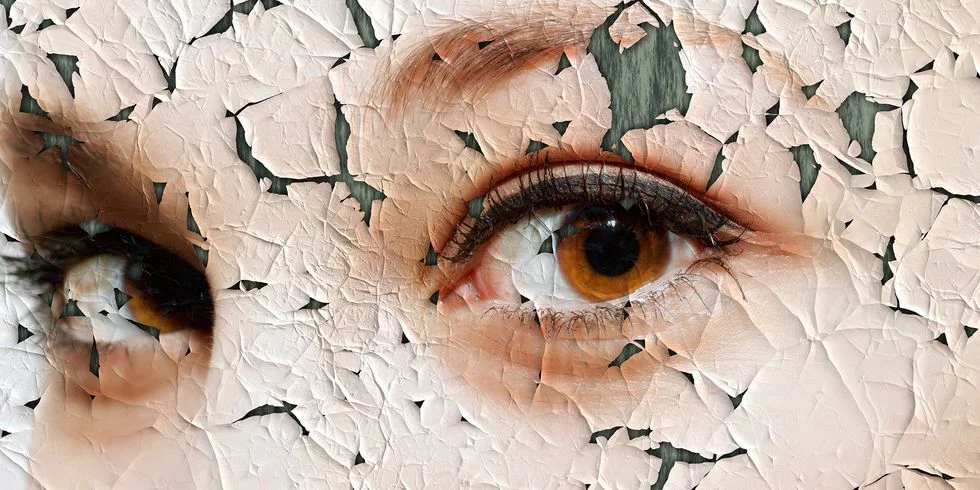 Exactly How To Treat The Eczema On Your Face