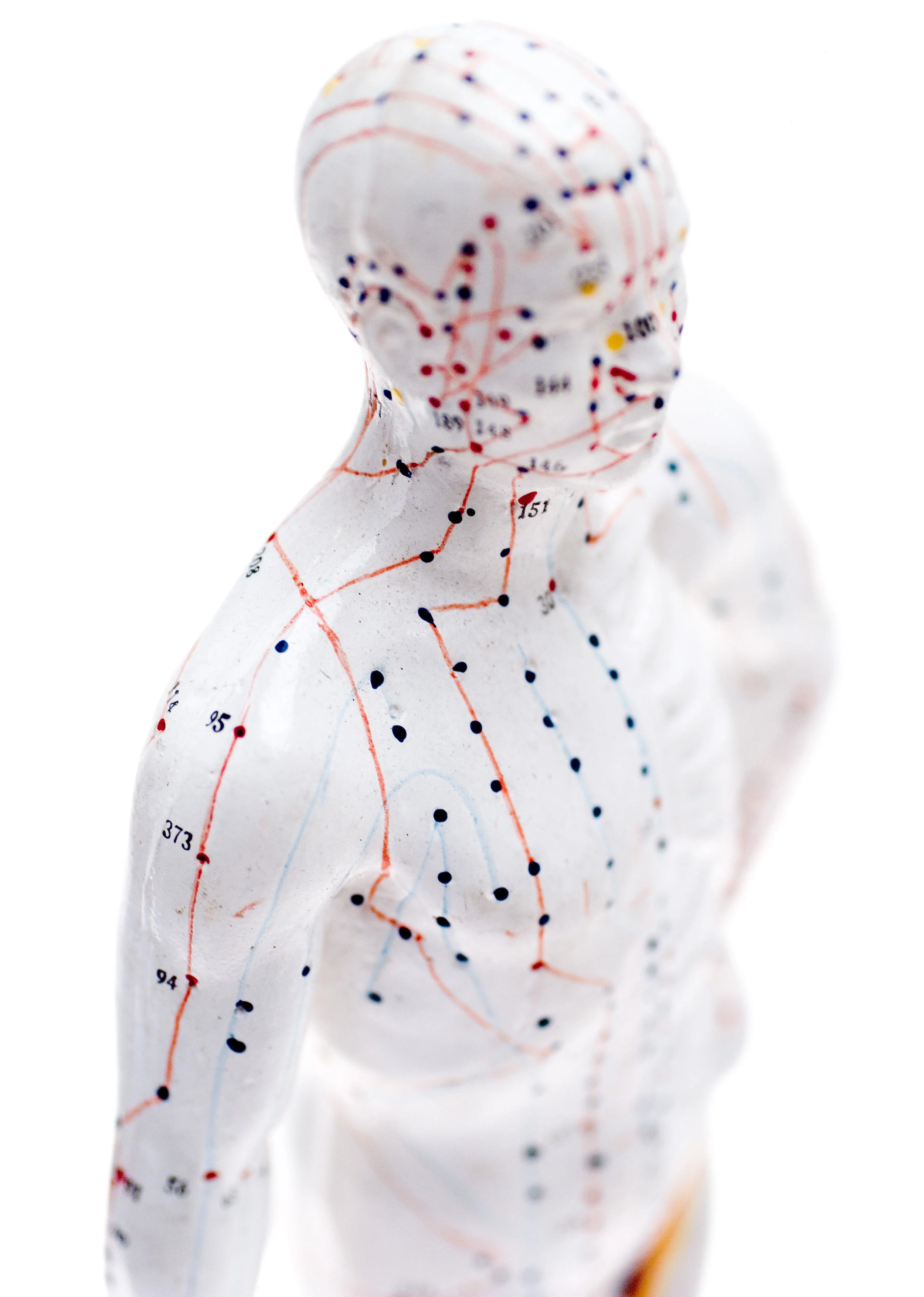 Acupuncture2.jpeg