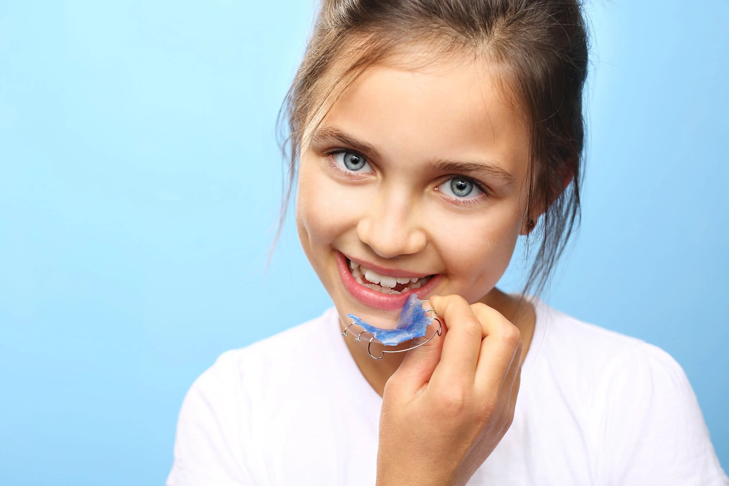 A Parent’s Guide to Retainers For Kids Legacy Orhtodontics — Legacy