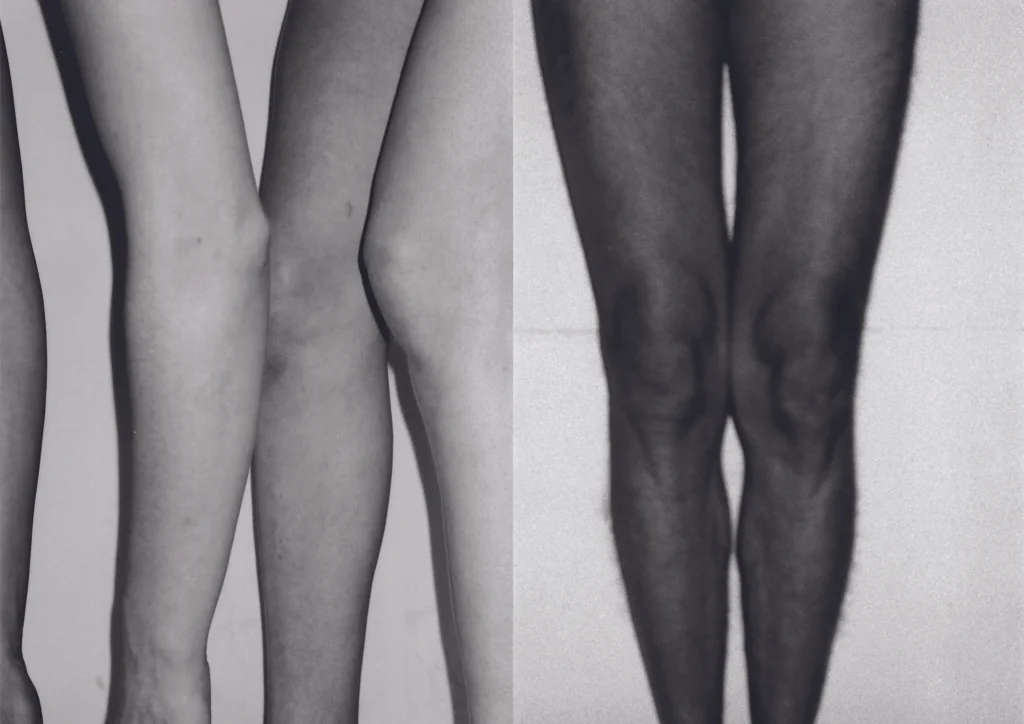 COMBINE # 13 1529/11, Vierfüsser, 2004, Barytabzug - 1290/36, Pair of legs, ganz (Der Schläfer), 2000, Barytabzug