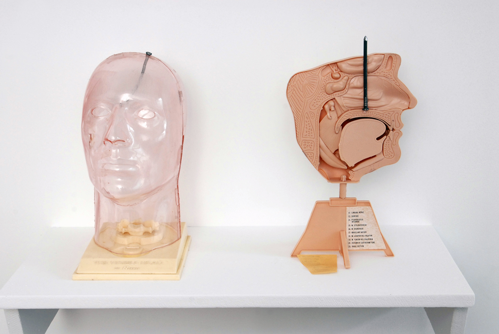 David Colossi, Annals of roentgenology Vol · XXII, Catherine Bastide gallery, Brussels, 2007, exhibition view