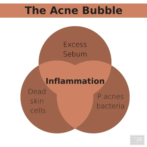 BSDAcneBubble.jpg