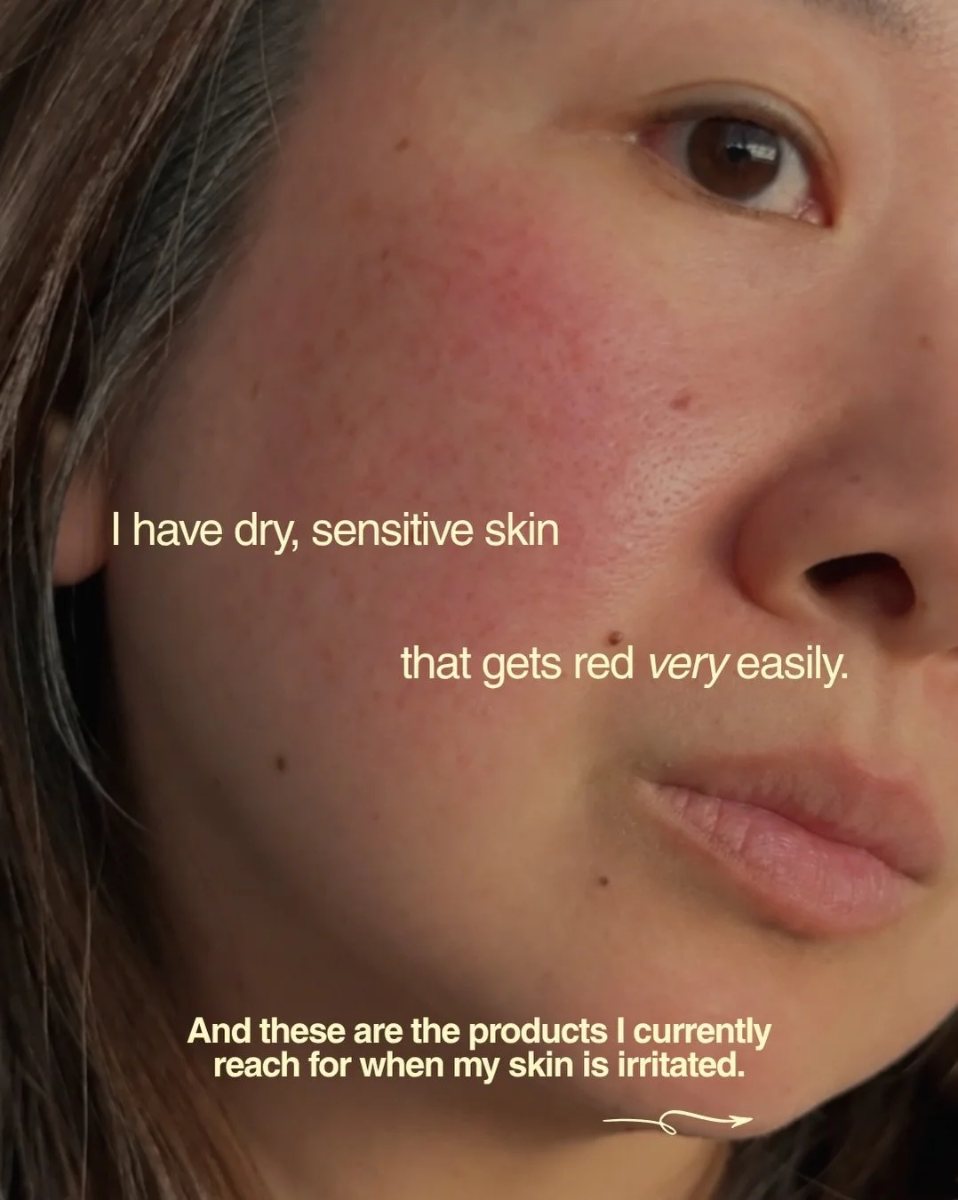 My skin gets angry sometimes and it has taken a lot of trial and error to find what works. And it&rsquo;s really an ongoing thing because the reason behind the redness is not always the same. These are some of my current favorites, whether I&rsquo;m 