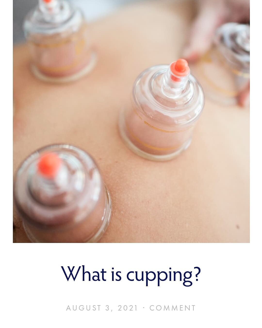 Ever wondered what cupping is and how it helps the body? Check out our  latest blog post to learn more! We explain the differences between traditional chinese medicine technique and orthopedic cupping which is what we use here at Soul Vibration Massa