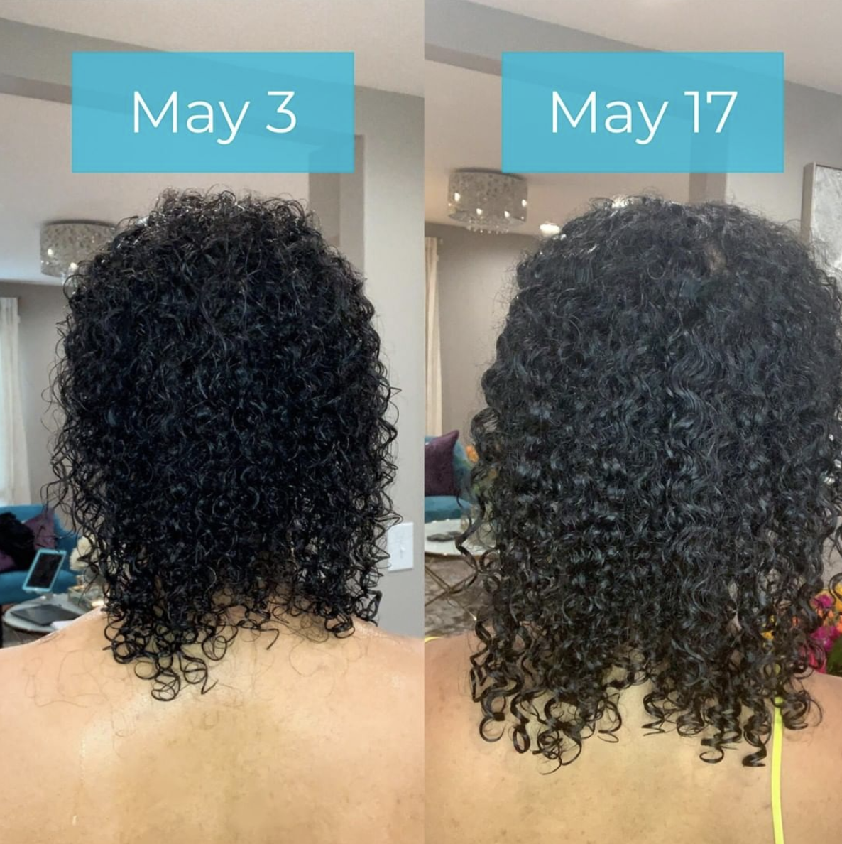 🌟 Grow and Strengthen Your Hair with Rice Water! [SP] — Congress Heights  on the Rise