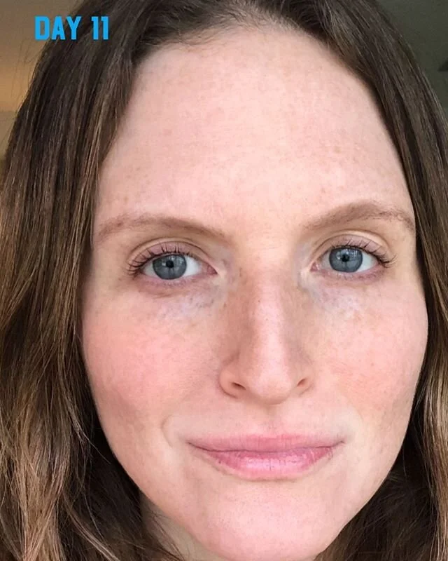 Ok everyone so here is my day 11, I promise you make-up free , filter-free selfie ( disclaimer: obviously those who know me know that there&rsquo;s a little bit of eyebrow gel going on but no makeup on my skin! ) AND incredibly no mascara either - yo