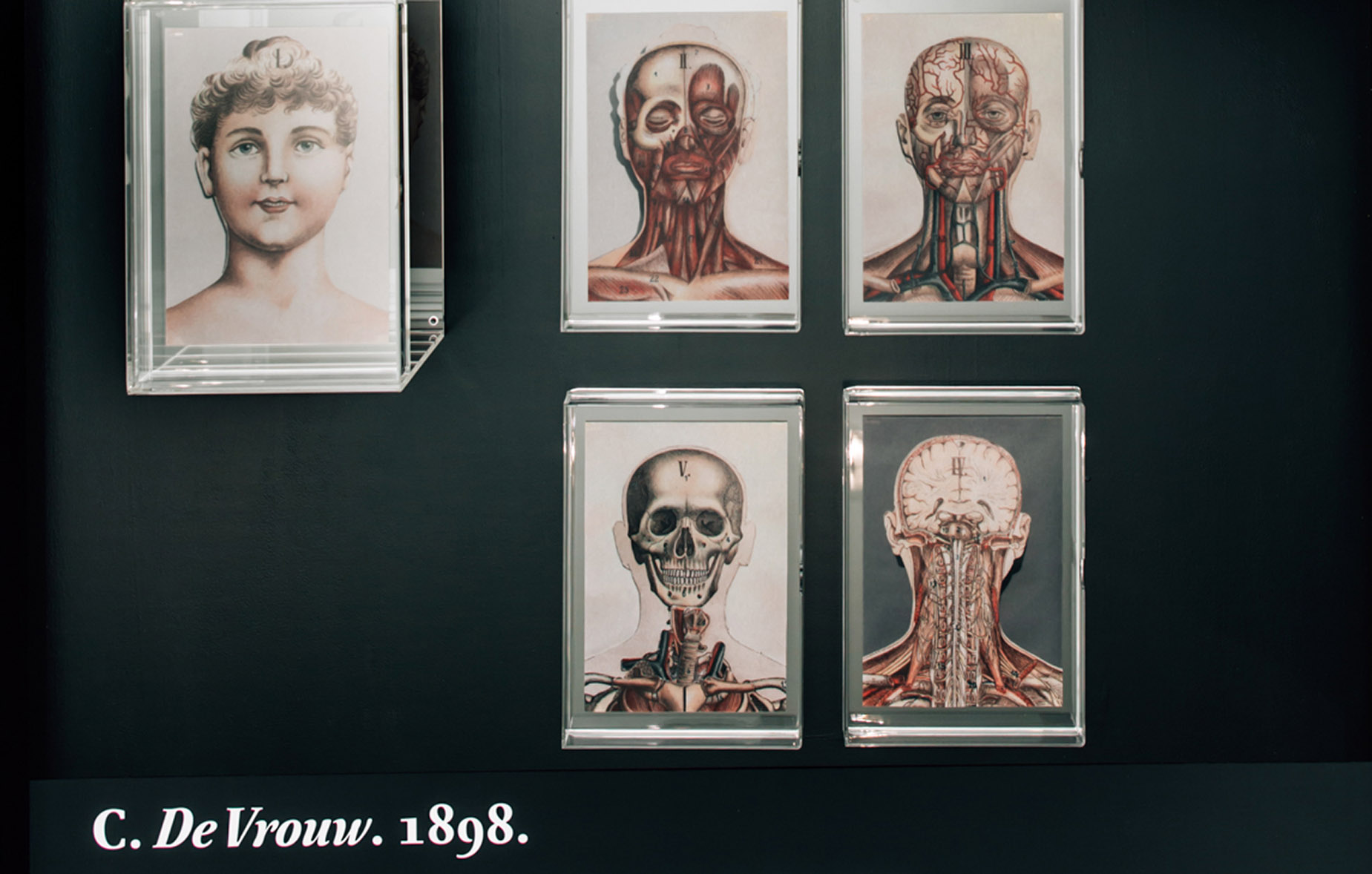 Paper Brains exhibition. Detail of the interactive exhibits. — Aletta Henriëtte Jacobs (1854–1929) earned her Doctorate in the University of Amsterdam in 1879, pioneering the women’s liberation movement. She later opened her practice as a medical doctor at the Herengracht. Above, there are images from her publication “The woman” recreating woman’s anatomy in a simple and informative manner, yet with a firm face that looks for an encounter with the eyes of the reader, almost re-affirming women’s rights to knowledge.
