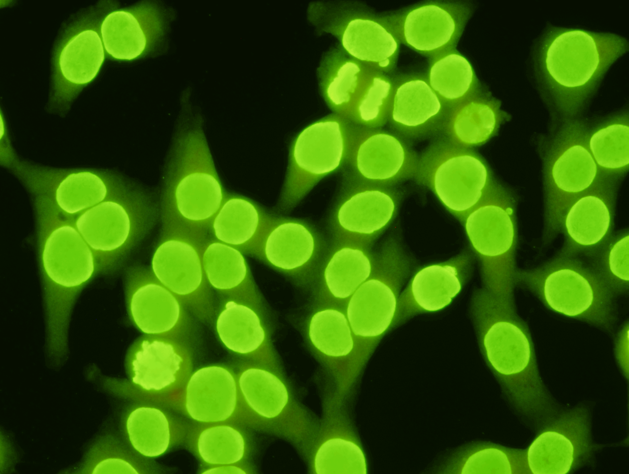  Anti-nuclear Antibody (HEp2 Cell Culture) Test Kit  Indirect Immunofluorescence Assay is a qualitative or semi-quantitative assay for the in vitro diagnostic detection of Anti-nuclear Antibodies in human serum on human epithelial cells (HEp2). &nbsp