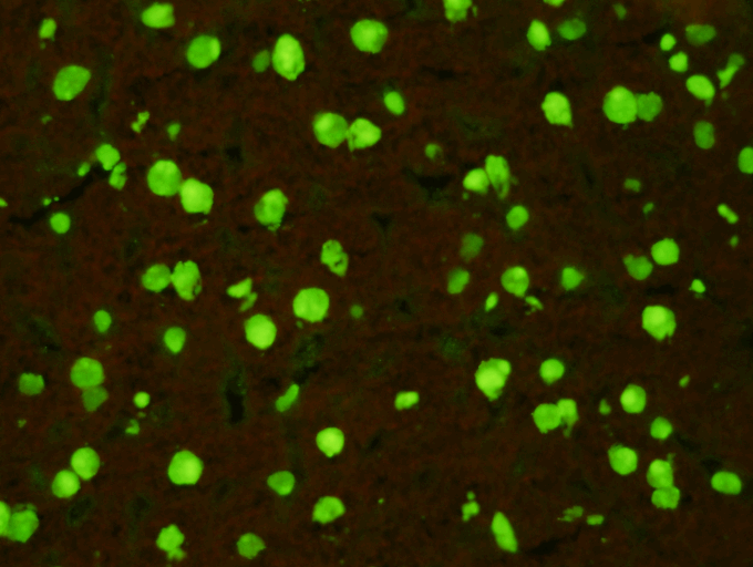  Anti-nuclear Antibody Test Kit  Indirect Immunofluorescence Assay for the detection of Anti-nuclear Antibodies in human serum on rat liver sections. The test is intended as an aid in the diagnosis of SLE and connective tissue diseases. &nbsp; 1048L 