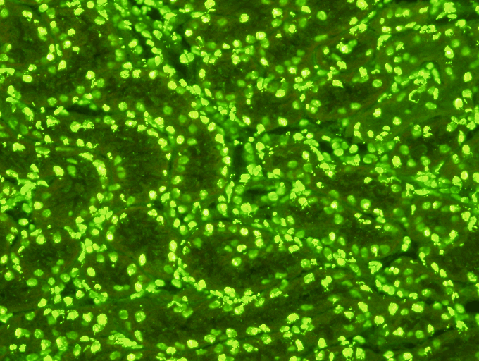 Autoscreen II Test Kit  Indirect Immunofluorescence Assay for the detection of &nbsp;Anti-nuclear (ANA), Mitochondrial (MA), Parietal Cell (PCA), Smooth Muscle (SMA) and Reticulin autoantibodies in human serum on rat or mouse liver/kidney/stomach se