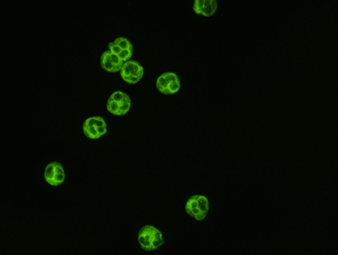  C-ANCA Test Kit  Indirect Immunofluorescence assay for the detection of Anti-Neutrophil Cytoplasmic antibodies in human serum using ethanol fixed human neutrophils as substrate. &nbsp;This test is intended as an aid in the diagnosis of Wegener's gra