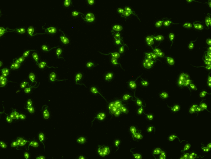  nDNA Antibody (Crithidia luciliae) Test Kit  An indirect Immunofluorescence assay the detection &nbsp;of antibodies to native dsDNA in human serum utilizing Crithidia luciliae antigen slides. &nbsp;ANA antibodies are present in theblood of patiences