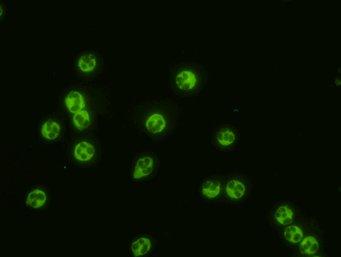  P-ANCA Test Kit  Indirect Immunofluorescence assay for the &nbsp;detection of Anti-Neutrophil Cytoplasmic antibodies in human serum using formalin fixed human neutrophils as substrate. &nbsp;This test is intended as an aid in the diagnosis of Wegene