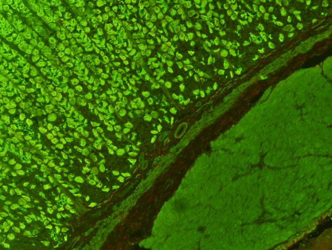  Parietal Cell Antibody Test Kit  Indirect Immunofluorescence Assay for the detection of Parietal Cell antibodies in human serum on rat stomach sections. &nbsp;Patients with antibodies to PCA or intrinsic factor (or both) have atrophy of the fundal m