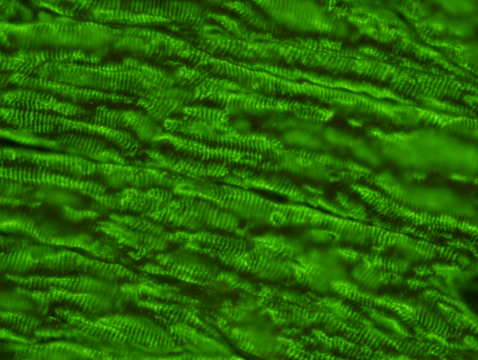  Striated Muscle Antibody Test Kit  Indirect Immunofluoresence assay &nbsp;for the detection of Striated antibodies in human serum on primate or rat striated muscle sections. Clinical and experimental evidence strongly suggests that circulating antib
